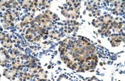 ZNF555 Antibody, Novus Biologicals 20&mu;L; Unlabeled:Antibodies, Polyclonal