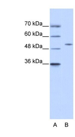 ZNF555 Antibody, Novus Biologicals 20&mu;L; Unlabeled:Antibodies, Polyclonal