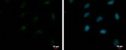 ZNF556 Antibody, Novus Biologicals 0.1mL:Antibodies, Polyclonal