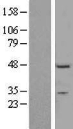 Novus Biologicals&trade;&nbsp;ZNF558 Overexpression Lysate