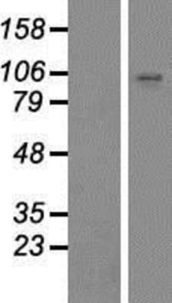 Novus Biologicals™ ZNF560 Overexpression Lysate