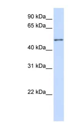 ZNF561 Antibody, Novus Biologicals 20&mu;L; Unlabeled:Antibodies, Polyclonal