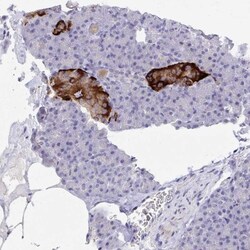 ZNF561 Antibody, Novus Biologicals 25 &mu;L, Unlabeled:Antibodies, Polyclonal