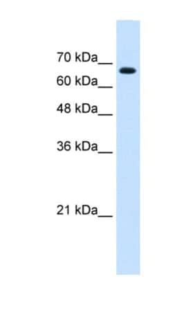 ZNF564 Antibody, Novus Biologicals 100μL; Unlabeled:Antibodies, Polyclonal