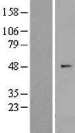 Novus Biologicals&trade;&nbsp;ZNF566 Overexpression Lysate