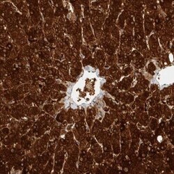 ZNF567 Antibody, Novus Biologicals 25ul | Buy Online | Novus Biologicals | Fisher Scientific