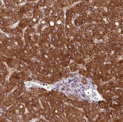 ZNF569 Antibody, Novus Biologicals 25 &mu;L, Unlabeled:Antibodies, Polyclonal