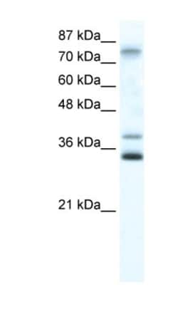 ZNF570 Antibody, Novus Biologicals:Antibodies:Primary Antibodies