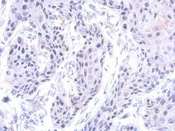 ZNF571 Antibody, Novus Biologicals 0.1mL; Unlabeled:Antibodies, Polyclonal