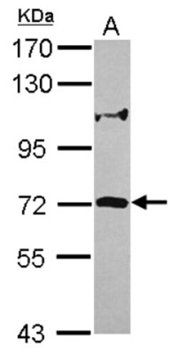 ZNF571 Antibody, Novus Biologicals 0.1mL; Unlabeled:Antibodies, Polyclonal