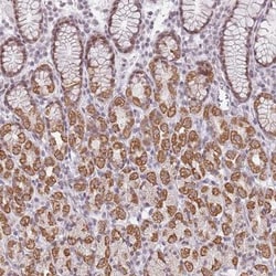ZNF574 Antibody, Novus Biologicals 25 &mu;L, Unlabeled:Antibodies, Polyclonal