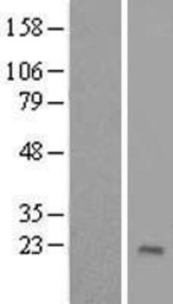 Novus Biologicals™ ZNF576 Overexpression Lysate
