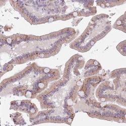 ZNF576 Antibody, Novus Biologicals:Antibodies:Primary Antibodies
