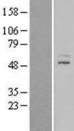 Novus Biologicals&trade;&nbsp;ZNF577 Overexpression Lysate