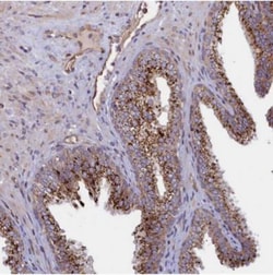 anti-ZNF577, Polyclonal, Novus Biologicals 0.1 mL | Buy Online | Novus Biologicals | Fisher Scientific