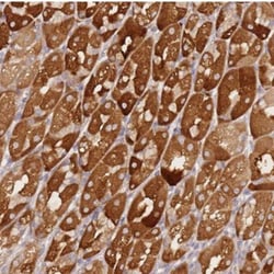 ZNF577 Antibody, Novus Biologicals 25 &mu;L, Unlabeled:Antibodies, Polyclonal