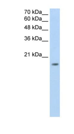 ZNF580 Antibody, Novus Biologicals 0.05mg; Unlabeled:Antibodies, Polyclonal