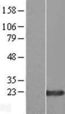 Novus Biologicals&trade;&nbsp;ZNF580 Overexpression Lysate
