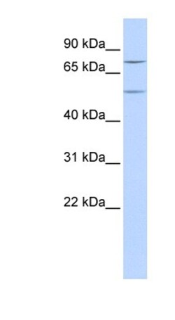 ZNF582 Antibody, Novus Biologicals 100&mu;L; Unlabeled:Antibodies, Polyclonal