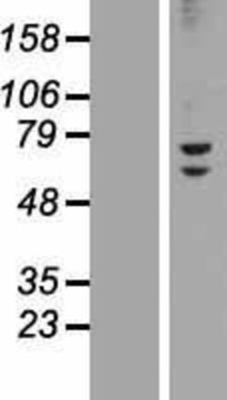 Novus Biologicals&trade;&nbsp;ZNF582 Overexpression Lysate