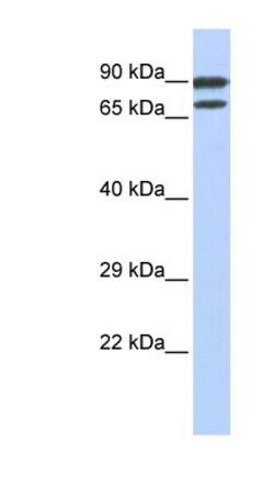 ZNF583 Antibody, Novus Biologicals 100&mu;L; Unlabeled:Antibodies, Polyclonal