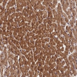 ZNF584 Antibody, Novus Biologicals:Antibodies:Primary Antibodies