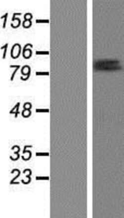 Novus Biologicals&trade;&nbsp;ZNF585B Overexpression Lysate