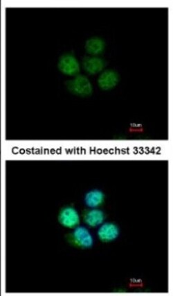 ZNF587 Antibody, Novus Biologicals 0.1mL; Unlabeled:Antibodies, Polyclonal