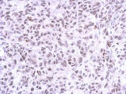 ZNF587 Antibody, Novus Biologicals 0.1mL; Unlabeled:Antibodies, Polyclonal