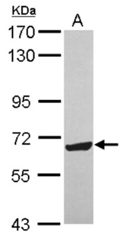 ZNF587 Antibody, Novus Biologicals 0.1mL; Unlabeled:Antibodies, Polyclonal