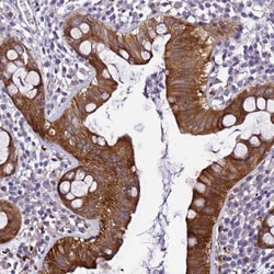 ZNF587 Antibody, Novus Biologicals 25 &mu;L, Unlabeled:Antibodies, Polyclonal