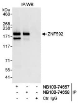 ZNF592 Antibody, Novus Biologicals 100 &mu;L | Buy Online | Novus Biologicals | Fisher Scientific