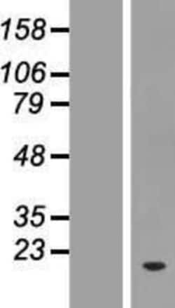 Novus Biologicals&trade;&nbsp;ZNF593 Overexpression Lysate