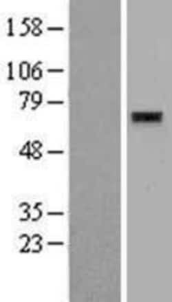 Novus Biologicals&trade;&nbsp;ZNF596 Overexpression Lysate
