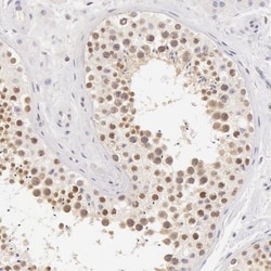 ZNF597 Antibody, Novus Biologicals 25 &mu;L; Unlabeled:Antibodies, Polyclonal