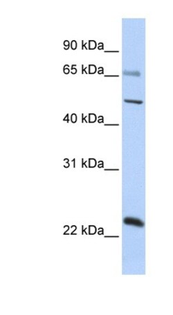 ZNF597 Antibody, Novus Biologicals™
