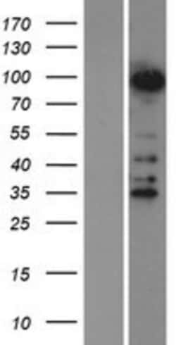 Novus Biologicals™ ZNF598 Overexpression Lysate