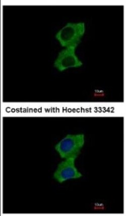ZNF598 Antibody, Novus Biologicals 0.1mL; Unlabeled:Antibodies, Polyclonal