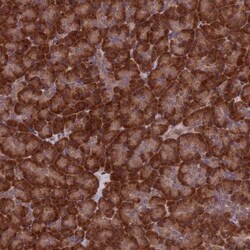 ZNF598 Antibody, Novus Biologicals 25 &mu;L; Unlabeled:Antibodies, Polyclonal