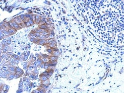 ZNF598 Antibody, Novus Biologicals 0.1mL; Unlabeled:Antibodies, Polyclonal