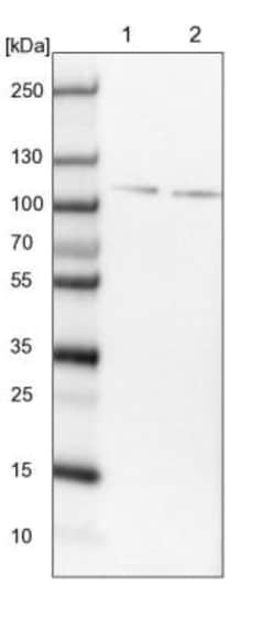 ZNF598 Antibody, Novus Biologicals 25 &mu;L; Unlabeled:Antibodies, Polyclonal