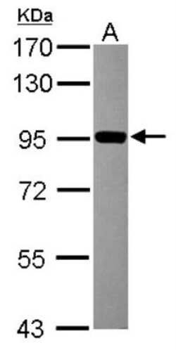 ZNF598 Antibody, Novus Biologicals 0.1mL; Unlabeled:Antibodies, Polyclonal