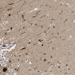 ZNF599 Antibody, Novus Biologicals:Antibodies:Primary Antibodies