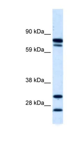 ZNF606 Antibody, Novus Biologicals 100&mu;L; Unlabeled:Antibodies, Polyclonal