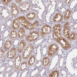 ZNF607 Antibody, Novus Biologicals:Antibodies:Primary Antibodies