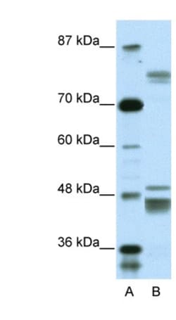 ZNF607 Antibody, Novus Biologicals 20&mu;L; Unlabeled:Antibodies, Polyclonal