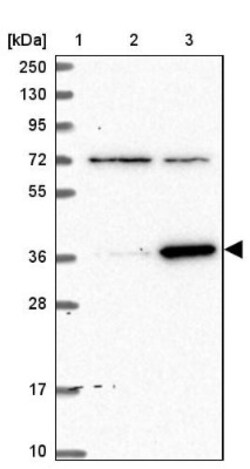 ZNF609 Antibody, Novus Biologicals 0.1mL; Unlabeled:Antibodies, Polyclonal