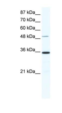 ZNF610 Antibody, Novus Biologicals:Antibodies:Primary Antibodies