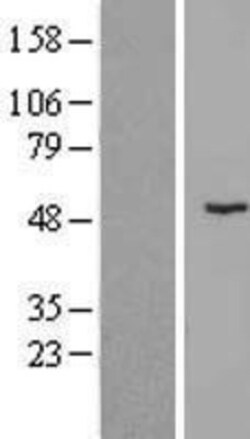 Novus Biologicals™ ZNF621 Overexpression Lysate