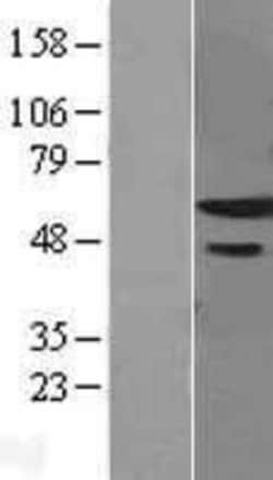 Novus Biologicals™ ZNF622 Overexpression Lysate